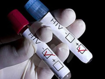 Các dấu hiệu nhiễm HIV ban đầu ở nam giới