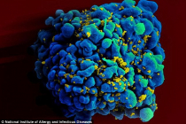 Tìm ra vắc xin ngừa HIV có phải là tin vui cho đàn ông chúng ta?