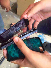 Iphone 5 phát nổ, nam thanh niên bị bỏng nặng